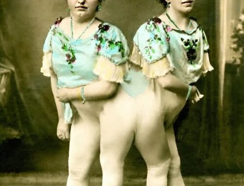 One of the Siamese Twins Got Pregnant and Gave Birth to a Son: This Is What Their Baby Looks Like One of the Siamese Twins Got Pregnant and Gave Birth to a Son: This Is What Their Baby Looks Like