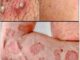 These are the consequences of sleeping with…See more