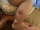 What’s wrong with this child? Possible serious skin infection.