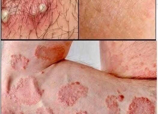 These are the consequences of sleeping with…See more These are the consequences of sleeping with…See more