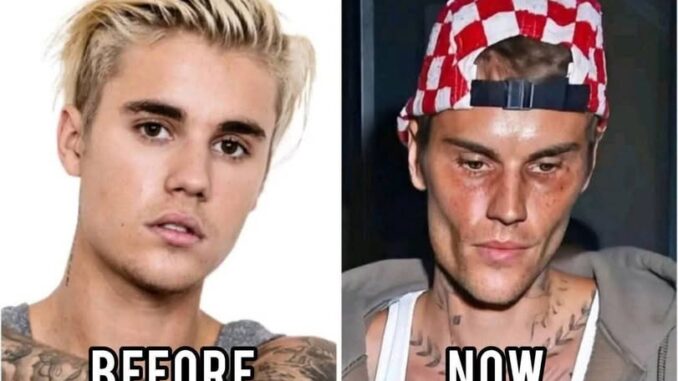 Pop Star Confession: Justin Bieber Reveals Positive Test Results Pop Star Confession: Justin Bieber Reveals Positive Test Results