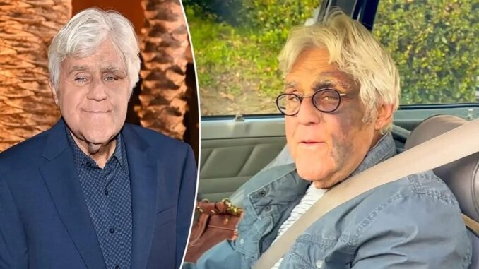 It breaks our hearts to confirm the news about the great Jay Leno, 74