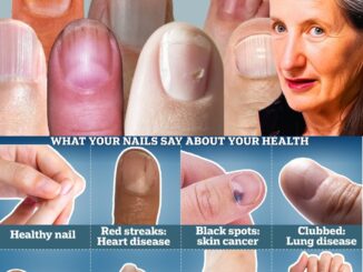 What Your Nails Say About Your Health: 9 Subtle Signs to Watch For