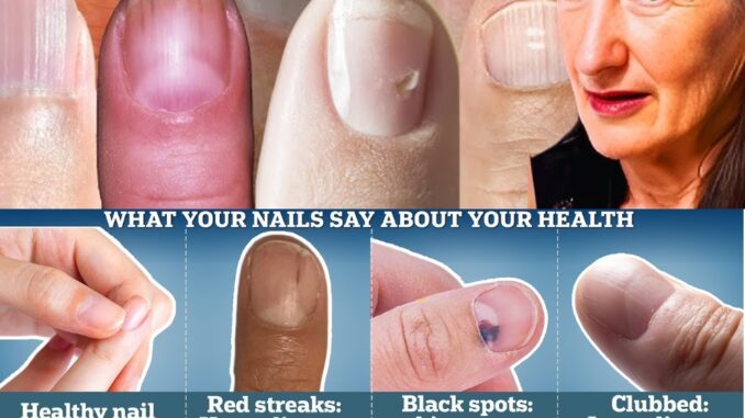 What Your Nails Say About Your Health: 9 Subtle Signs to Watch For What Your Nails Say About Your Health: 9 Subtle Signs to Watch For
