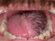 These are the consequences of eating …See more