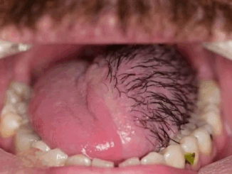 These are the consequences of eating …See more