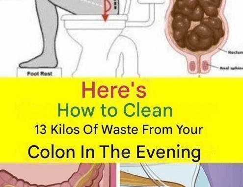 Learn how to cleanse 15 kilograms of waste from your colon overnight. Learn how to cleanse 15 kilograms of waste from your colon overnight.