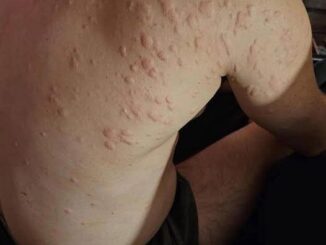 Unexpected Consequences of Sleeping with the Wrong Person”