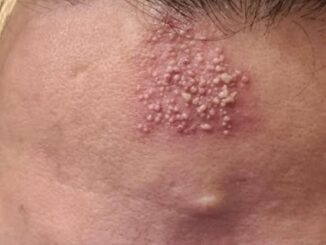 These are the consequences of sleeping with…See more