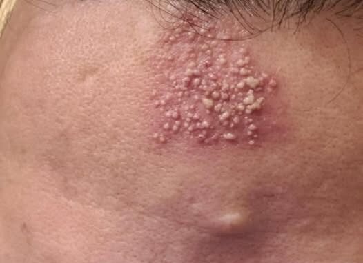 These are the consequences of sleeping with…See more These are the consequences of sleeping with…See more