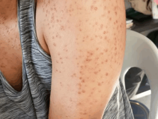 These are the consequences of sleeping with the…See more