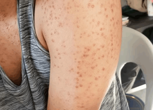 These are the consequences of sleeping with the…See more These are the consequences of sleeping with the…See more