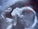 The doctors couldn’t believe what they saw during the ultrasound. But when the baby was born, her charm, strength, and story touched hearts around the world in the most unexpected ways.