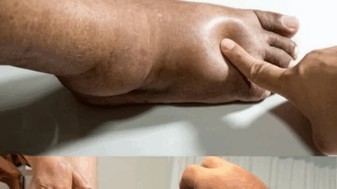The Best Foods to Help Reduce Swollen Hands and Feet Naturally The Best Foods to Help Reduce Swollen Hands and Feet Naturally