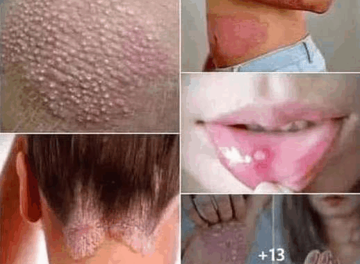 Signs of Human Papillomavirus (HPV) You Shouldn’t Ignore Signs of Human Papillomavirus (HPV) You Shouldn’t Ignore