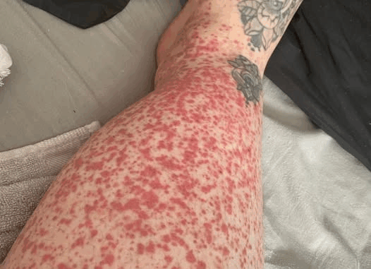 These are the consequences of sleeping with… These are the consequences of sleeping with…