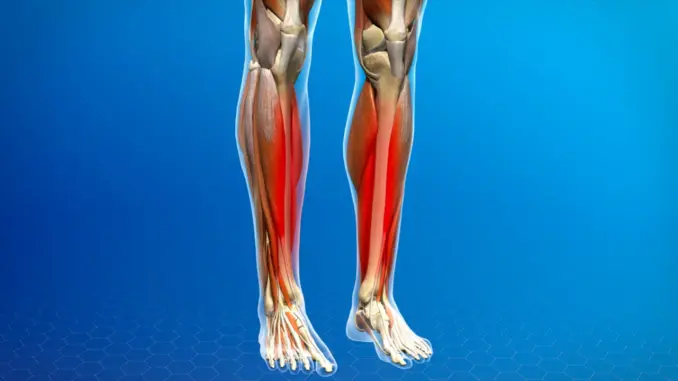 The vitamin the body lacks when legs and bones are painful The vitamin the body lacks when legs and bones are painful