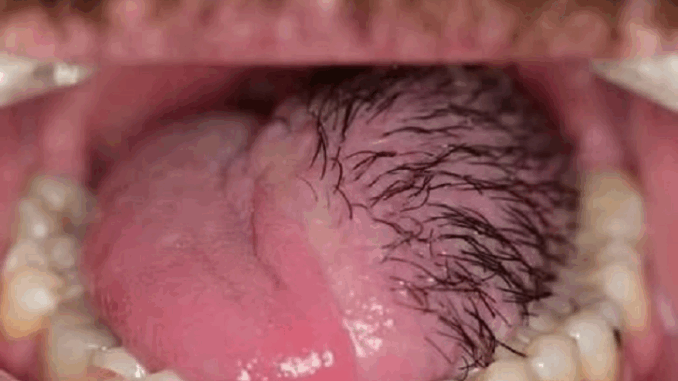 These are the consequences of eating …See more These are the consequences of eating …See more