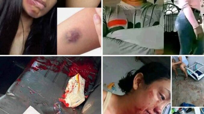 Young woman dies at the hands of her… See more Young woman dies at the hands of her… See more